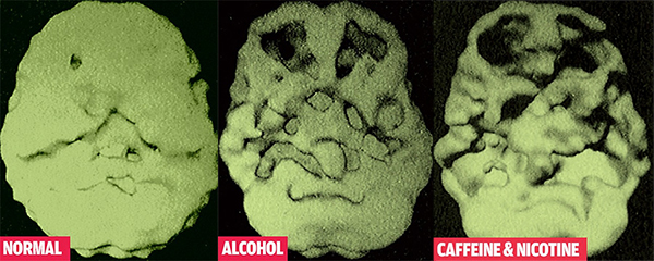 normal-alcohol-sigarette-brain